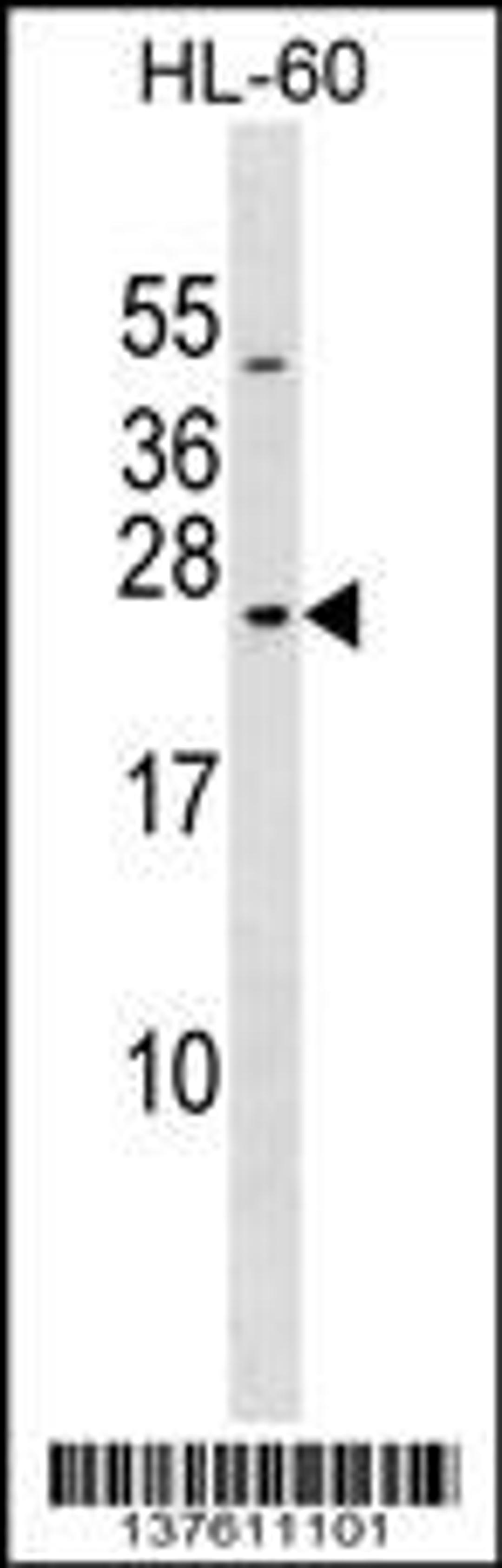 Western blot analysis in HL-60 cell line lysates (35ug/lane).