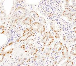 Detection of human SNRPA1 by immunohistochemistry.