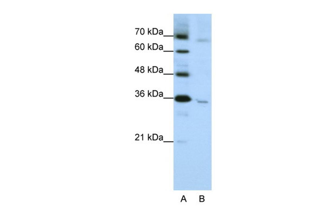 Antibody used in WB on Human HepG2 at 1.25 ug/ml.