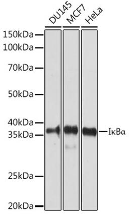 Western blot - I?Ba antibody (A1187)