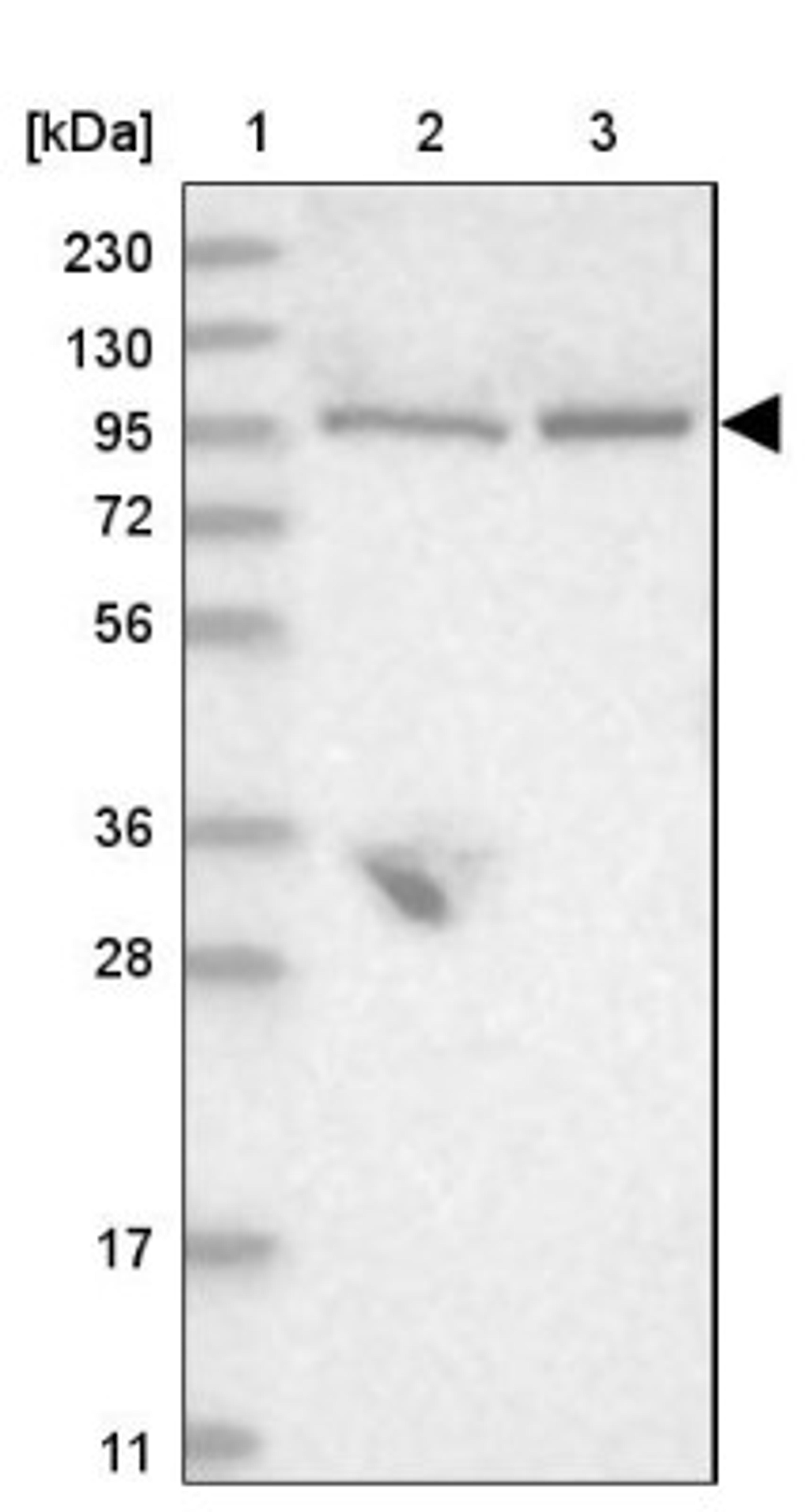 Western Blot: FAAP100 Antibody [NBP1-90467] - Lane 1: Marker [kDa] 230, 130, 95, 72, 56, 36, 28, 17, 11<br/>Lane 2: Human cell line RT-4<br/>Lane 3: Human cell line U-251MG sp