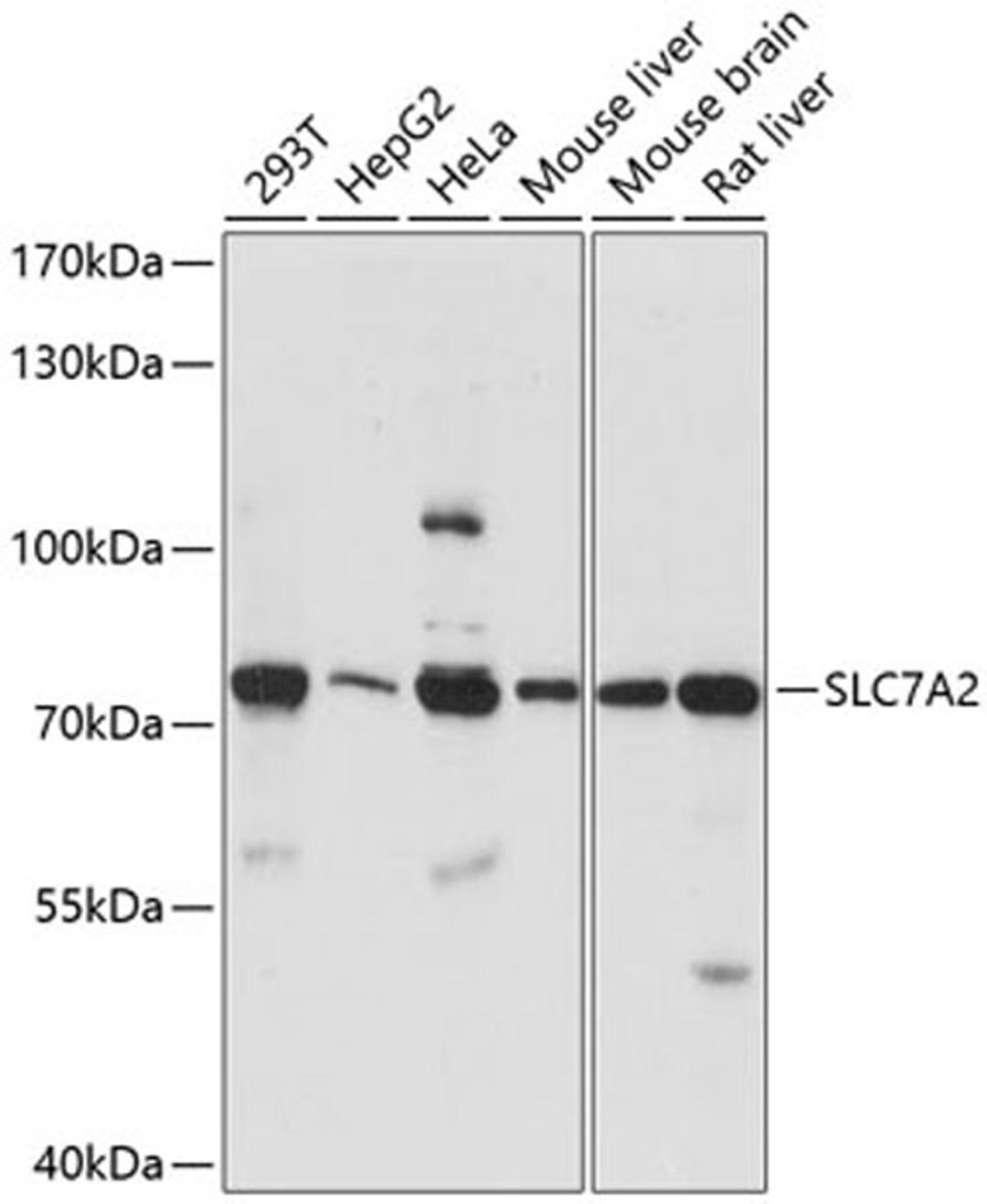 Western blot - SLC7A2 antibody (A14574)