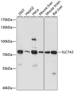 Western blot - SLC7A2 antibody (A14574)