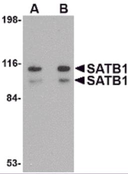 Western blot analysis of SATB1 in SK-N-SH cell lysate with SATB1 antibody at (A) 1 and (B) 2 &#956;g/mL.