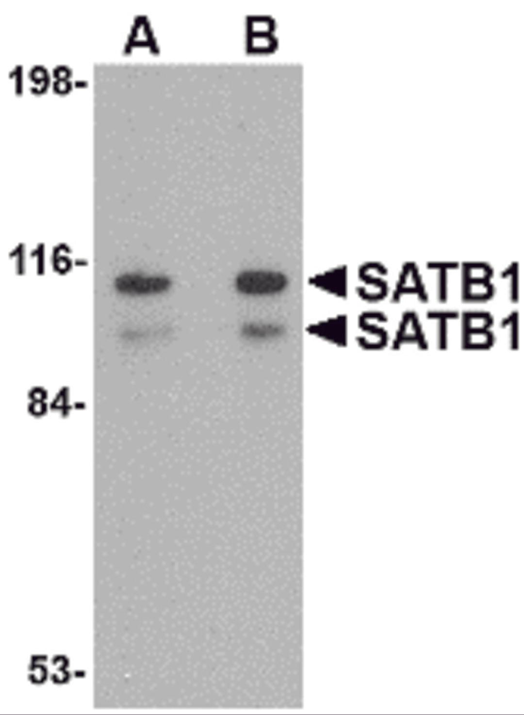 Western blot analysis of SATB1 in SK-N-SH cell lysate with SATB1 antibody at (A) 1 and (B) 2 μg/mL.