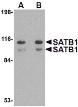 Western blot analysis of SATB1 in SK-N-SH cell lysate with SATB1 antibody at (A) 1 and (B) 2 μg/mL.