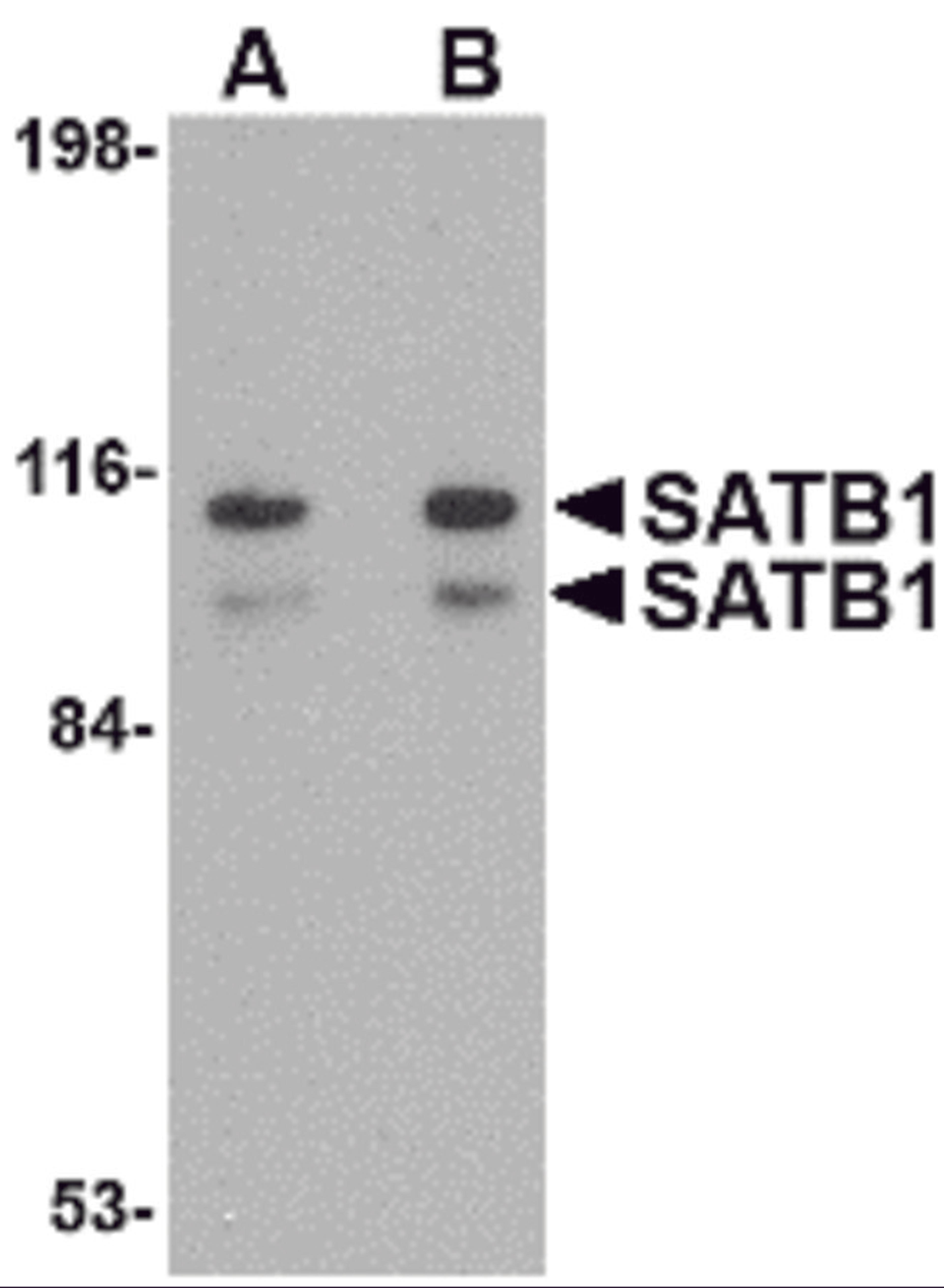 Western blot analysis of SATB1 in SK-N-SH cell lysate with SATB1 antibody at (A) 1 and (B) 2 μg/mL.