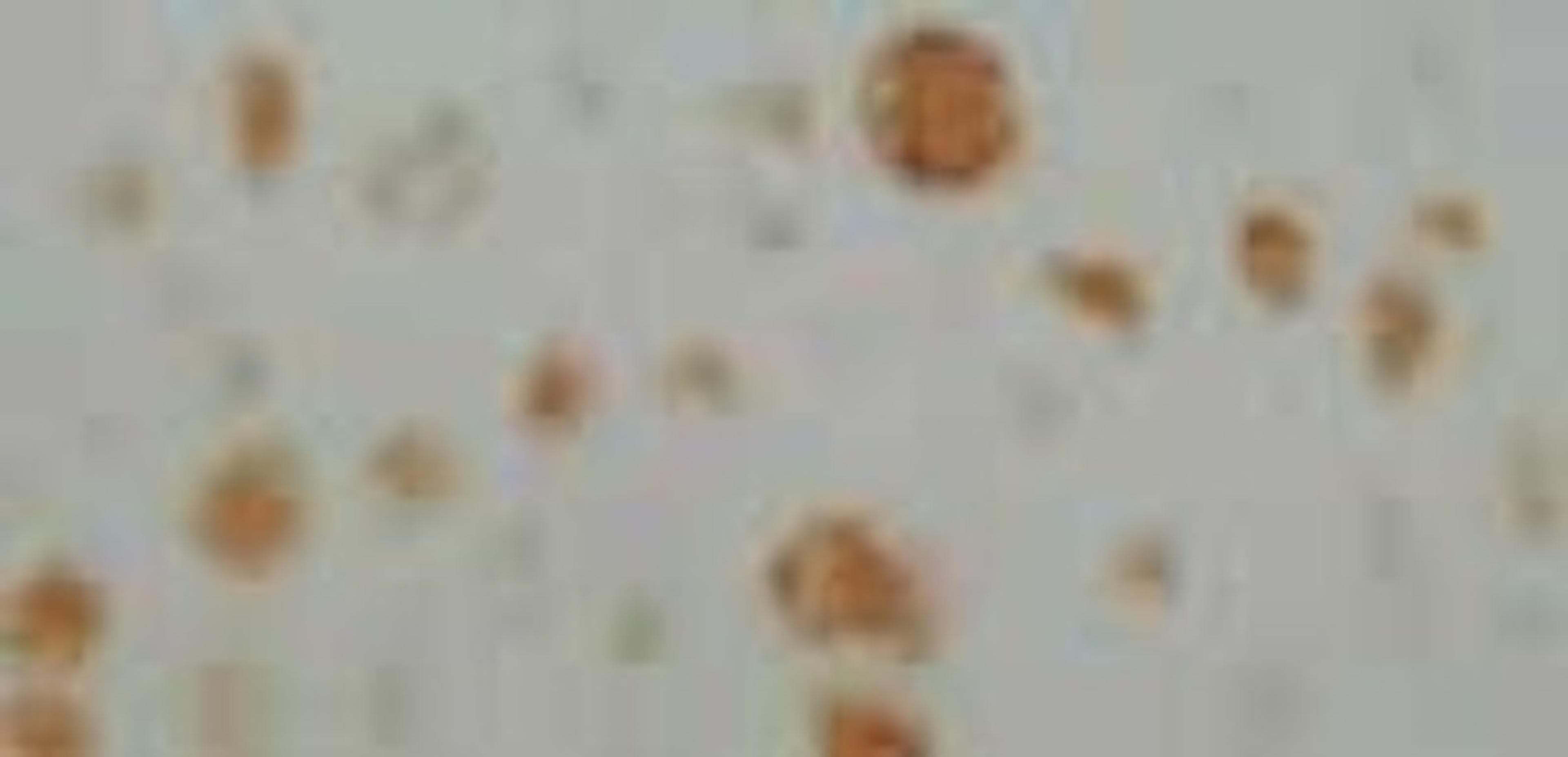 Immunohistochemistry: Neurofibromin 1 Antibody [NB300-155] - NF1 protein labeling displays positive signal in the maturing and the hypertrophic cartilages but only faint labeling in the proliferative cartilage.