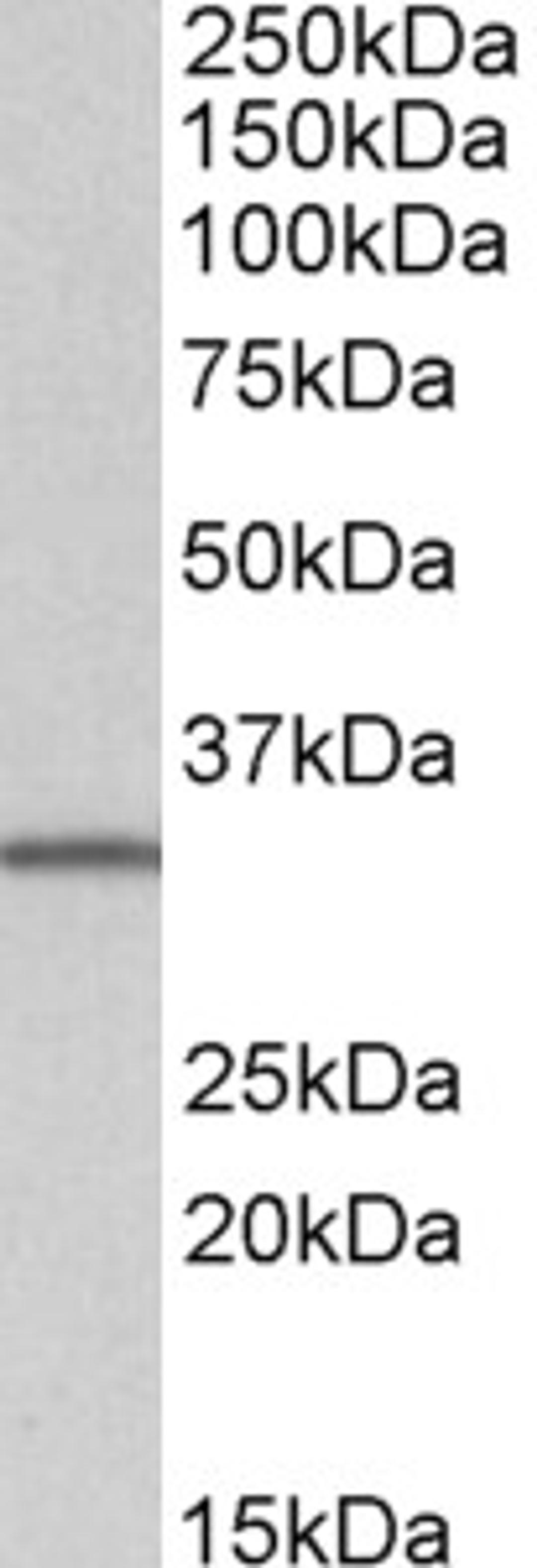 45-967 (1ug/ml) staining of Daudi lysate (35ug protein in RIPA buffer). Primary incubation was 1 hour. Detected by chemiluminescence.