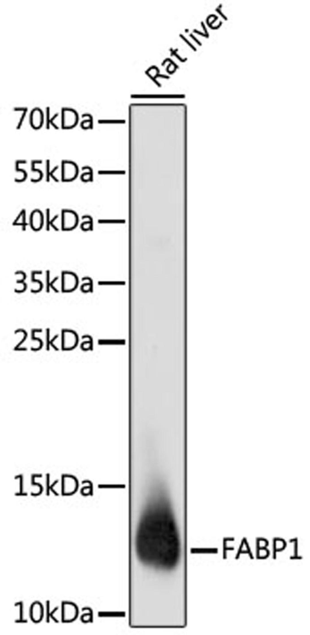 Western blot - FABP1 antibody (A5311)