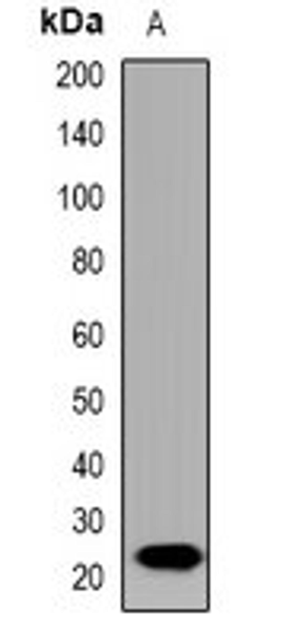 Western blot analysis of rat brain (Lane1) whole cell lysates using IL19 antibody