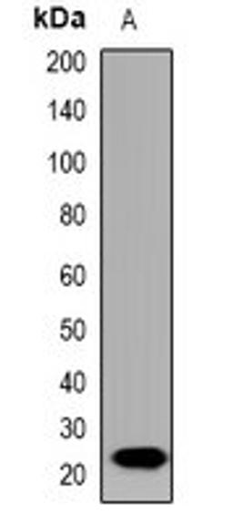 Western blot analysis of rat brain (Lane1) whole cell lysates using IL19 antibody