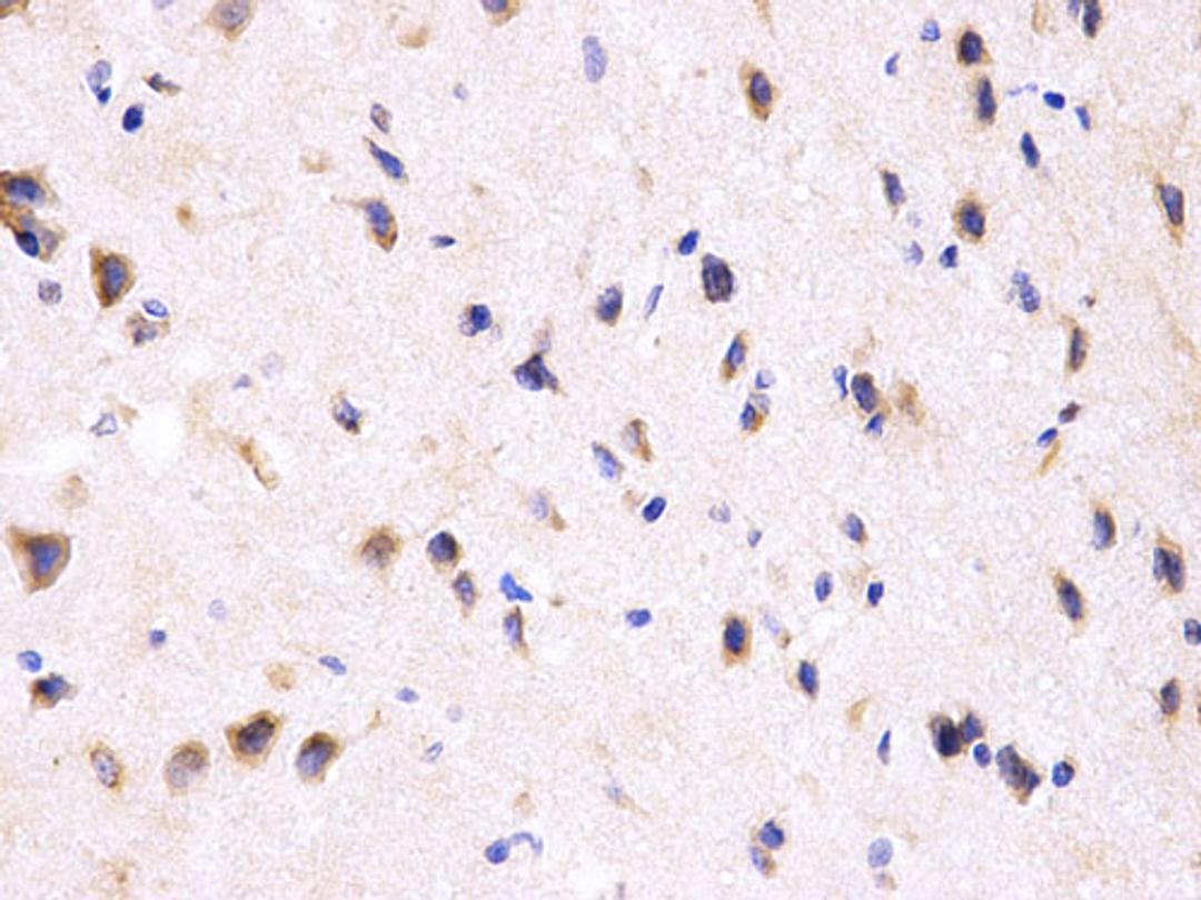 Immunohistochemistry - PPP2R4 Antibody (A1912)
