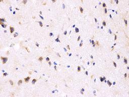 Immunohistochemistry - PPP2R4 Antibody (A1912)