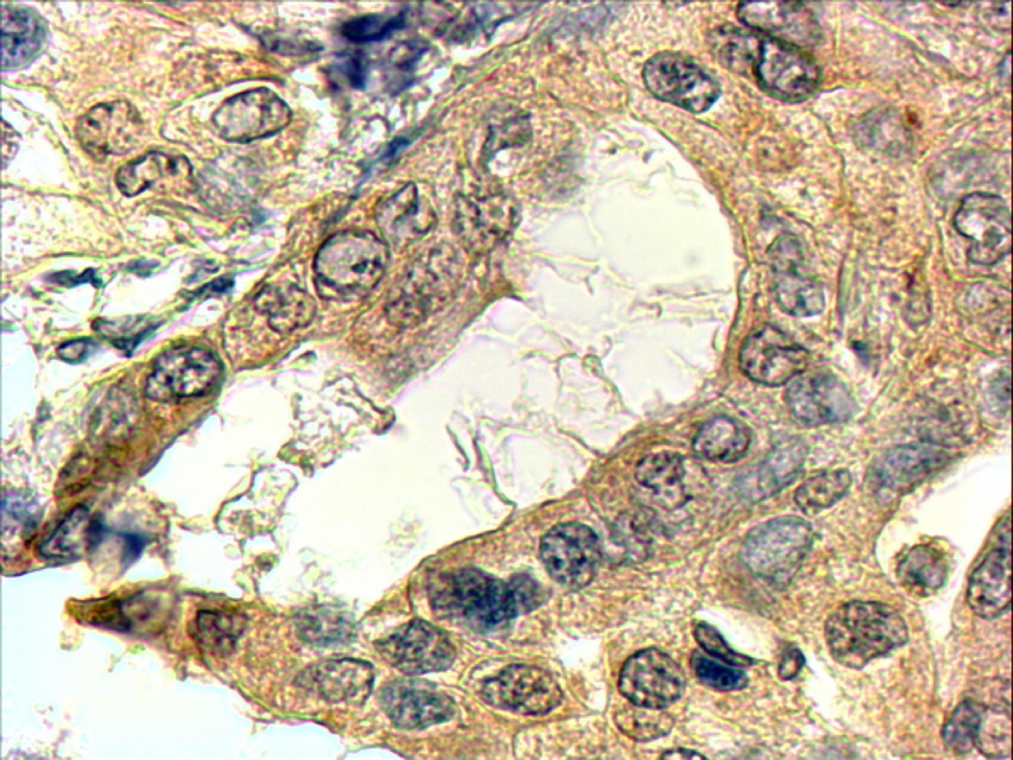 46-431 (4ug/ml) staining of paraffin embedded Human Prostate. Steamed antigen retrieval with Tris/EDTA buffer pH 9, HRP-staining.