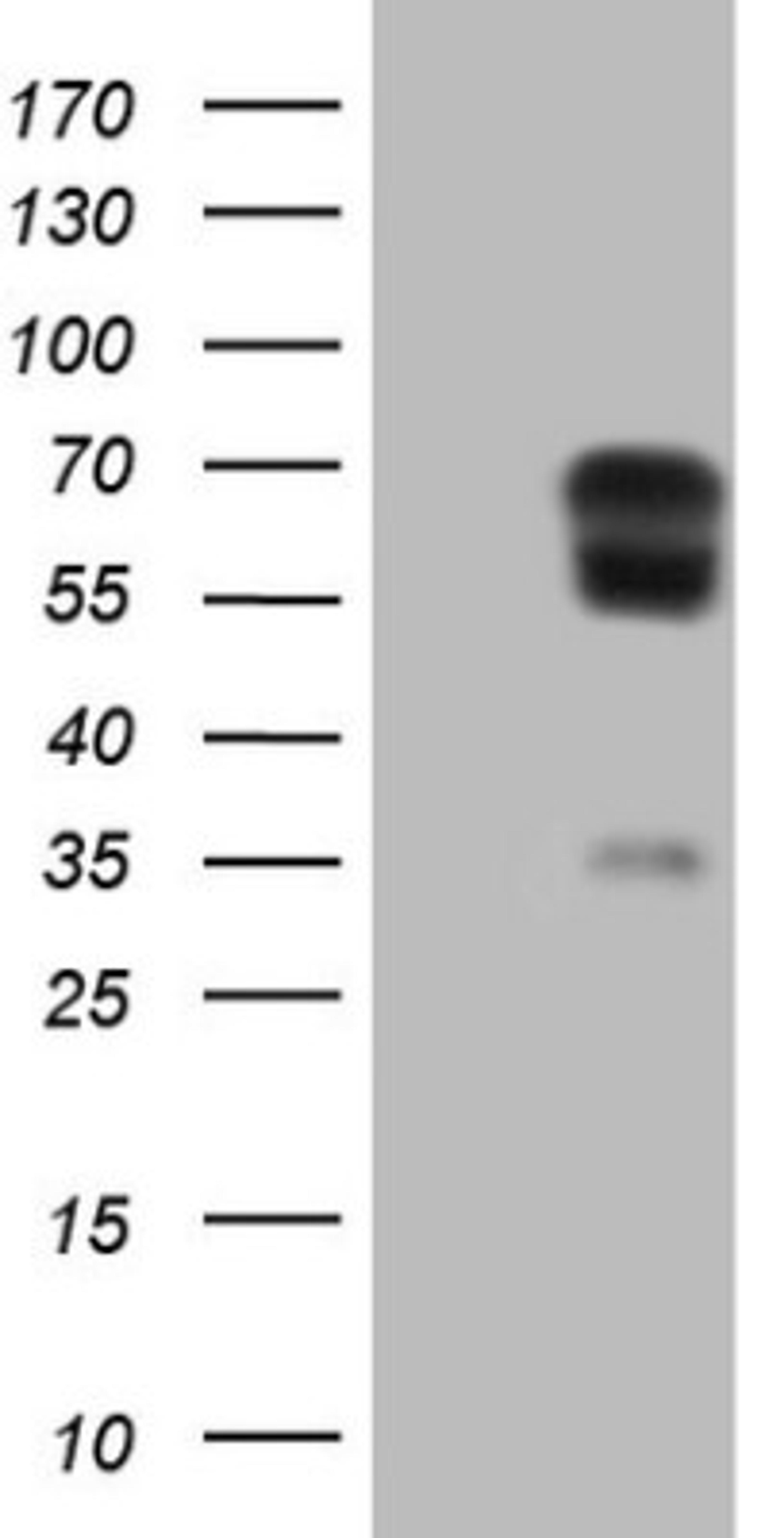 Western Blot: t-Plasminogen Activator/tPA Antibody (3H3) [NBP2-46435] - Analysis of HEK293T cells were transiently transfected with the pCMV6-ENTRY control (Left lane) or pCMV6-ENTRY t-Plasminogen.