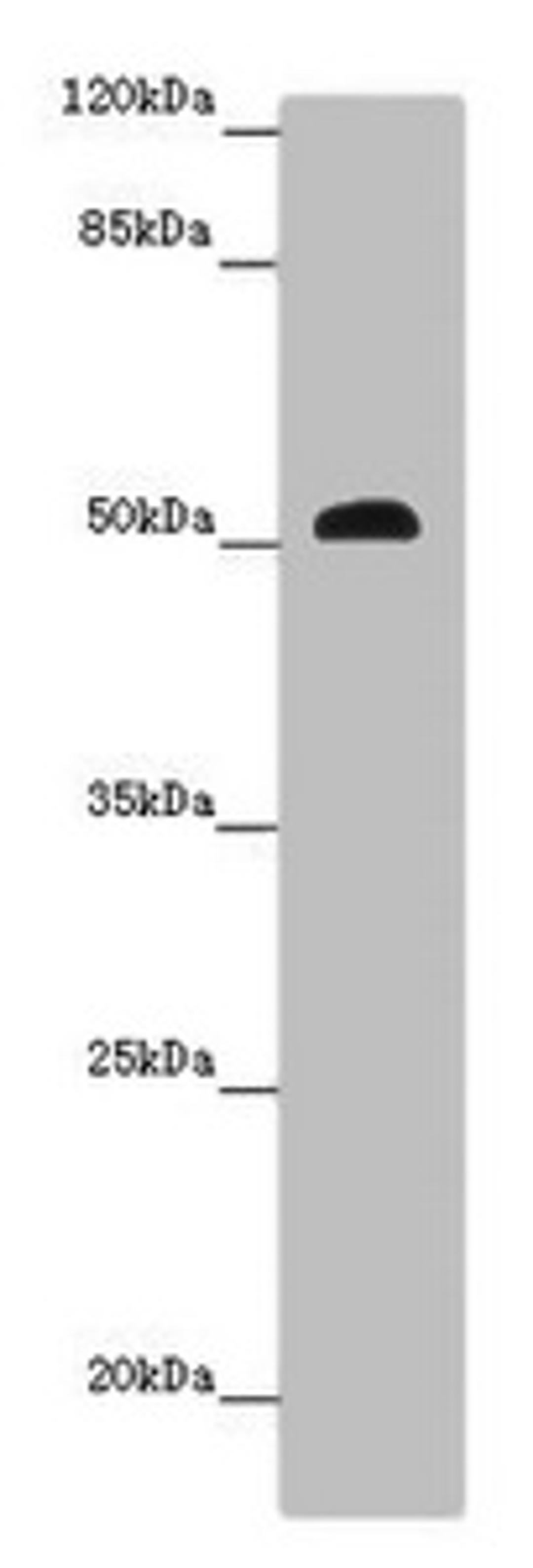 Western blot. All lanes: SCPEP1 antibody at 9 ug/ml + Mouse stomach tissue. Secondary. Goat polyclonal to rabbit IgG at 1/10000 dilution. Predicted band size: 51, 33 kDa. Observed band size: 51 kDa. 