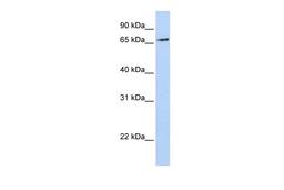 Antibody used in WB on Human MCF-7 at 0.2-1 ug/ml.