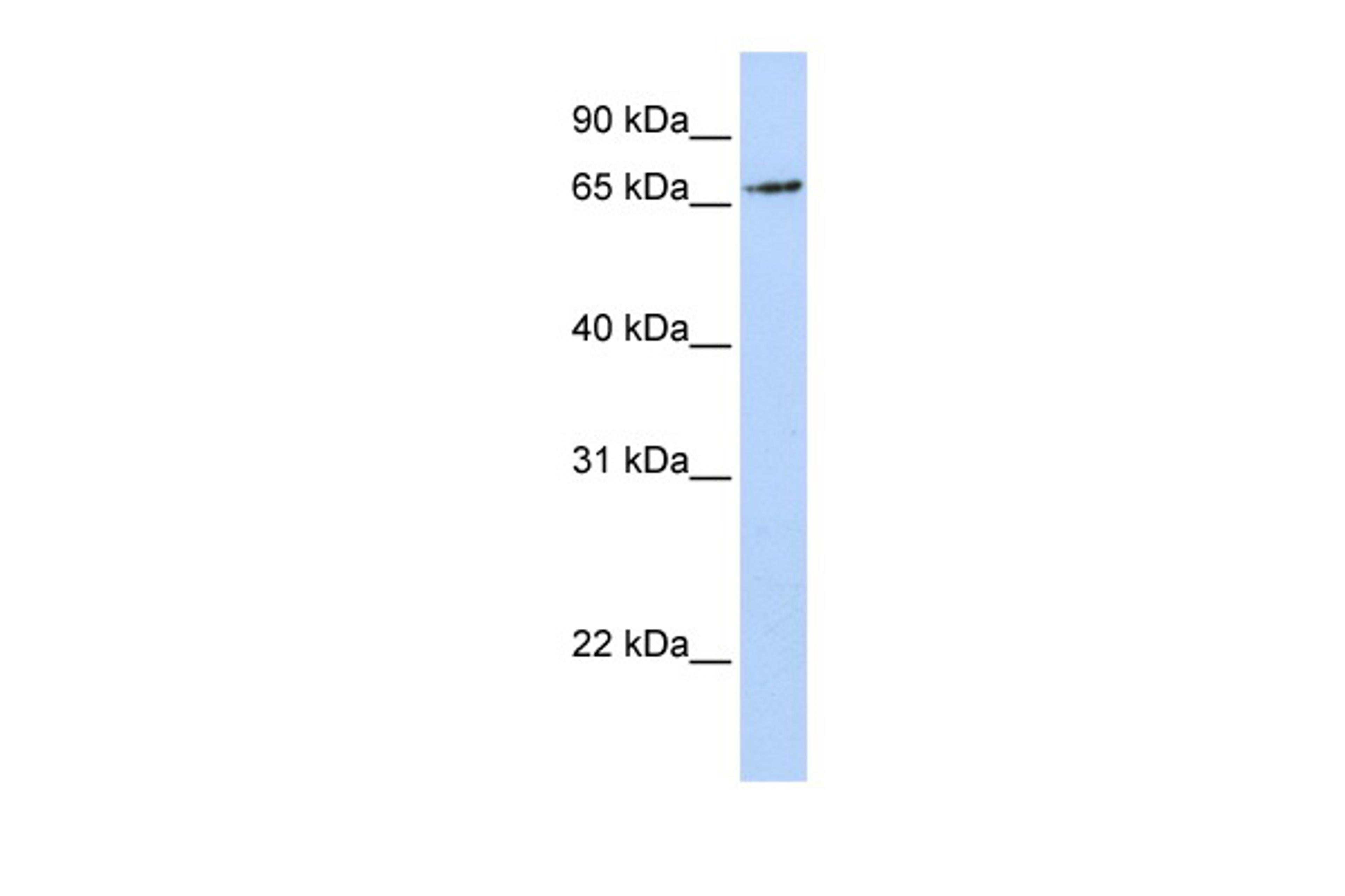 Antibody used in WB on Human MCF-7 at 0.2-1 ug/ml.