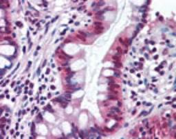 Immunohistochemistry-Paraffin: SR1 Antibody [NBP2-24479] - Analysis of human small intestine using this antibody at 10 ug/ml.