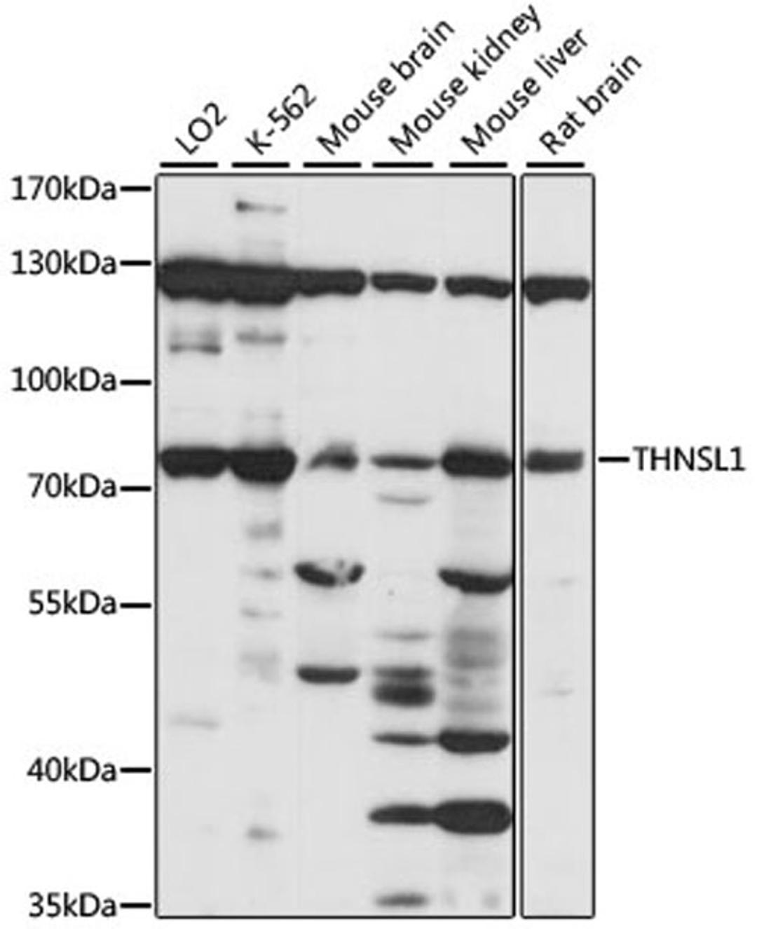 Western blot - THNSL1 antibody (A15515)