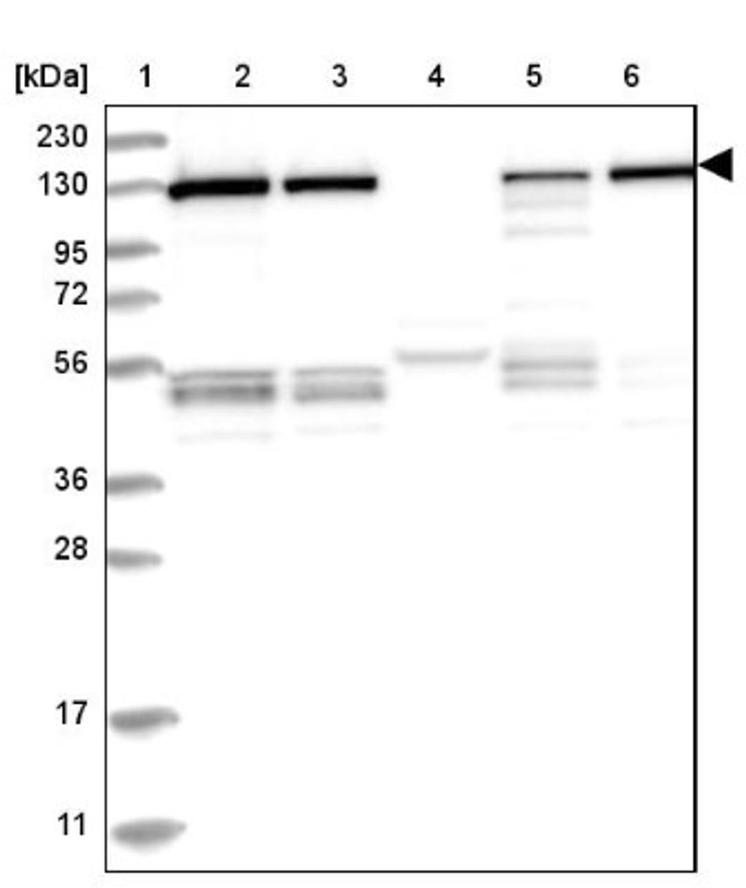 Western Blot: RAB3GAP1 Antibody [NBP2-38206] - Lane 1: Marker [kDa] 230, 130, 95, 72, 56, 36, 28, 17, 11<br/>Lane 2: RT-4<br/>Lane 3: U-251 MG<br/>Lane 4: Human Plasma<br/>Lane 5: Liver<br/>Lane 6: Tonsil