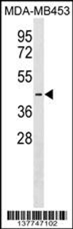 Western blot analysis in MDA-MB453 cell line lysates (35ug/lane).