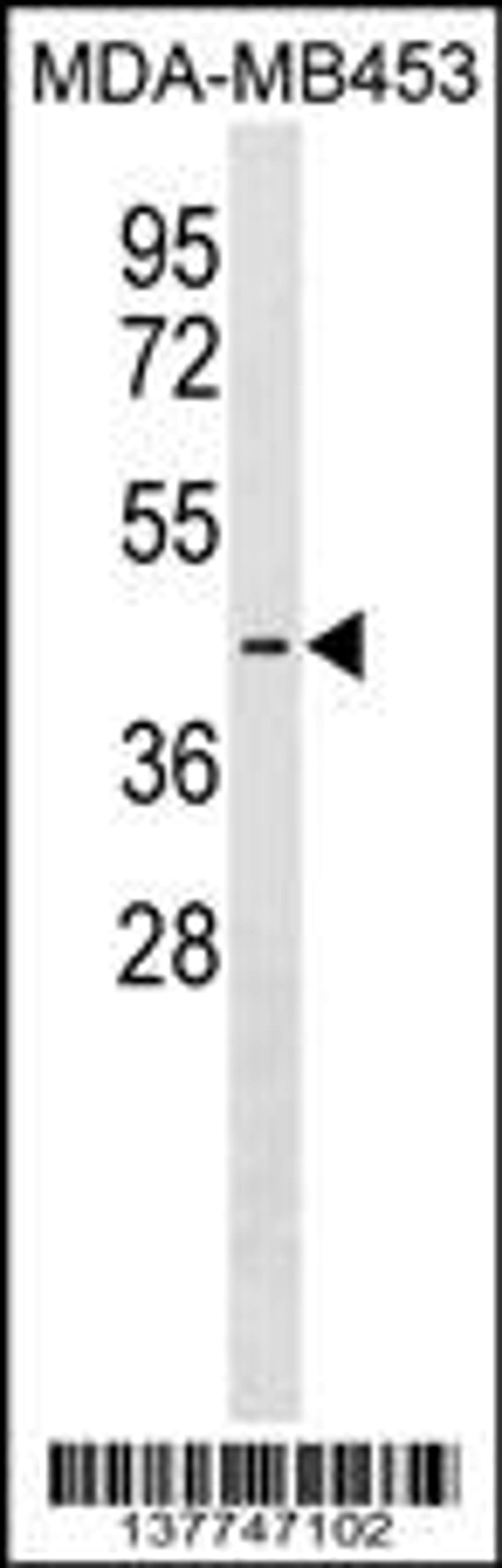 Western blot analysis in MDA-MB453 cell line lysates (35ug/lane).