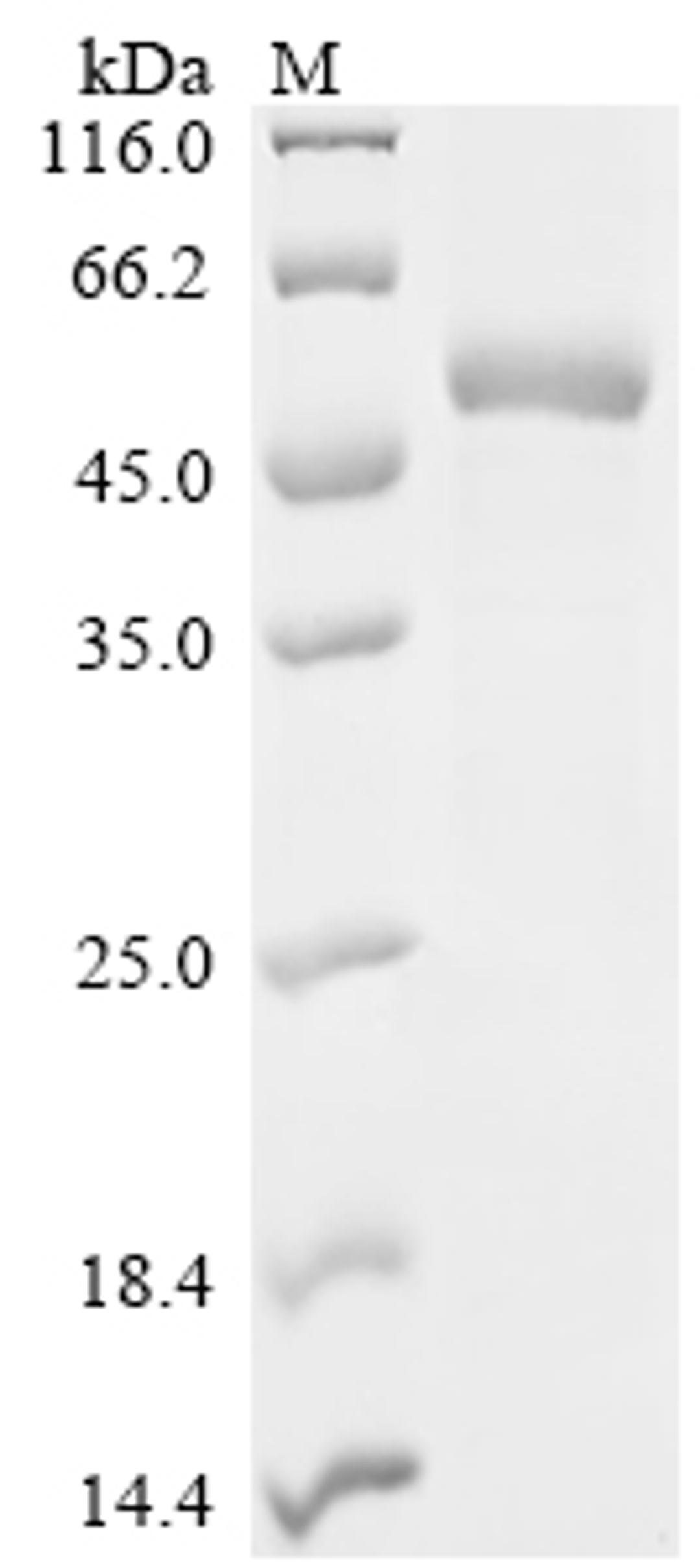 (Tris-Glycine gel) Discontinuous SDS-PAGE (reduced) with 5% enrichment gel and 15% separation gel.