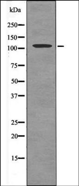 Western blot analysis of PMA treated A549 whole cell lysates using FLT3 -Phospho-Tyr591- antibody