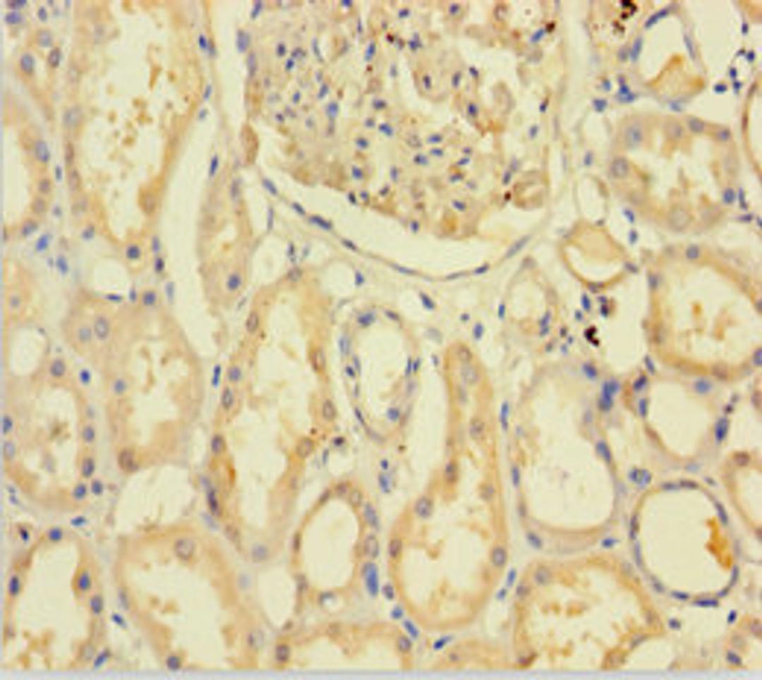 Immunohistochemistry of paraffin-embedded human kidney tissue using CSB-PA842710LA01HU at dilution of 1:100