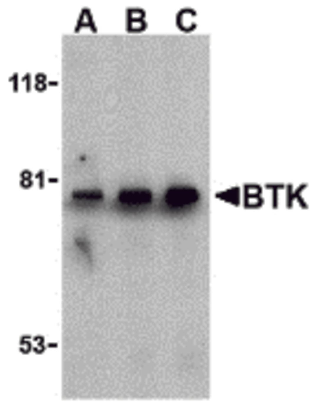 Western blot analysis of BTK in U937 cell lysate with BTK antibody at (A) 0.5, (B) 1, and (C) 2 &#956;g/mL.