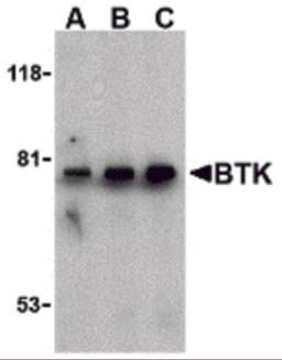 Western blot analysis of BTK in U937 cell lysate with BTK antibody at (A) 0.5, (B) 1, and (C) 2 &#956;g/mL.