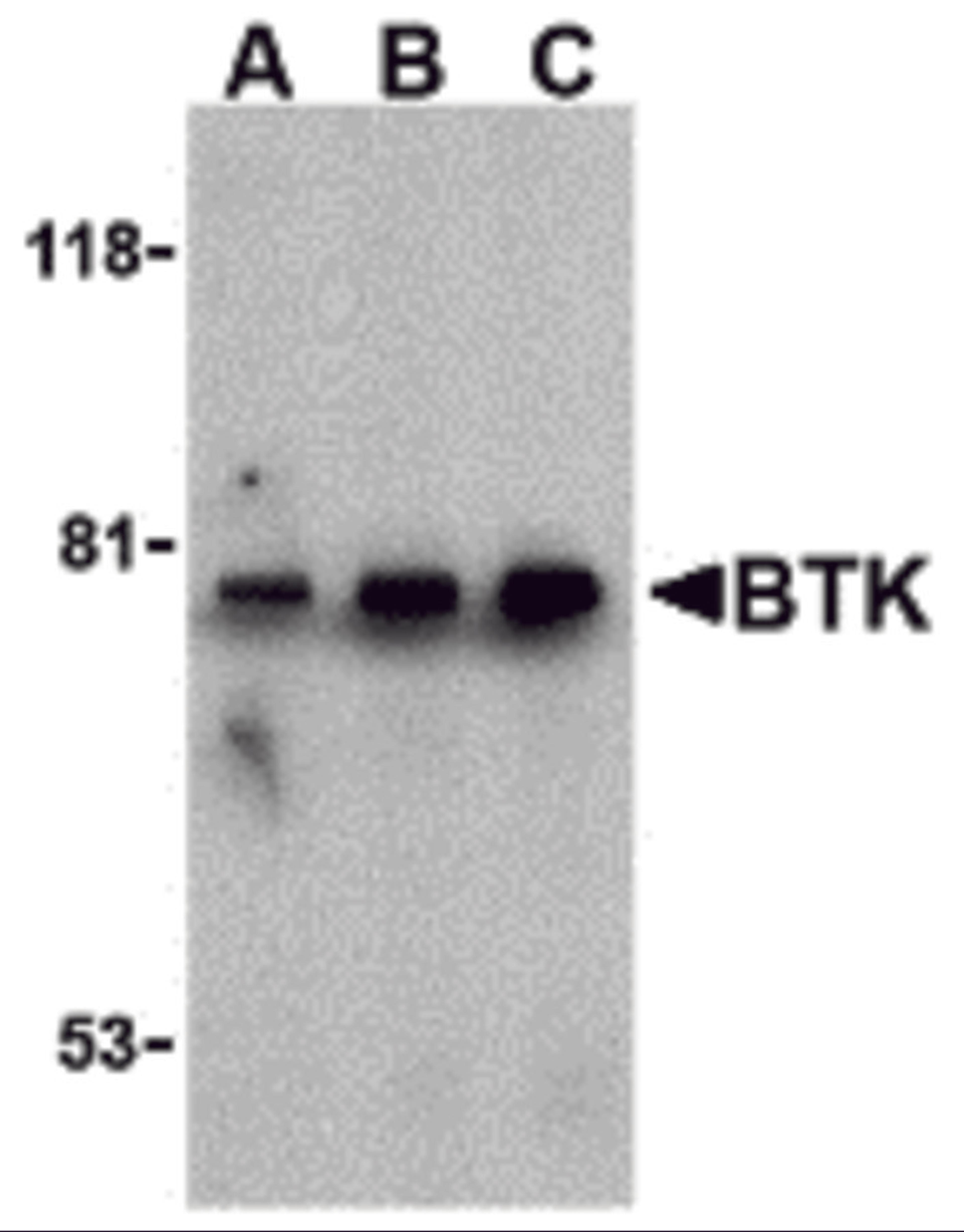 Western blot analysis of BTK in U937 cell lysate with BTK antibody at (A) 0.5, (B) 1, and (C) 2 &#956;g/mL.