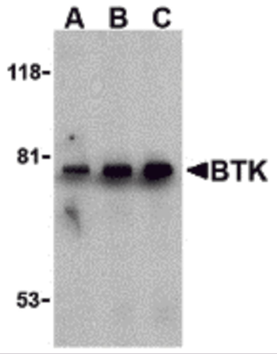 Western blot analysis of BTK in U937 cell lysate with BTK antibody at (A) 0.5, (B) 1, and (C) 2 μg/mL.