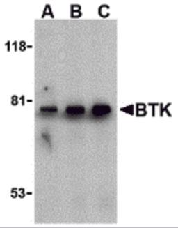 Western blot analysis of BTK in U937 cell lysate with BTK antibody at (A) 0.5, (B) 1, and (C) 2 μg/mL.