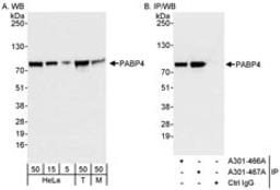 Detection of human and mouse PABP4 by western blot (h&m) and immunoprecipitation (h).