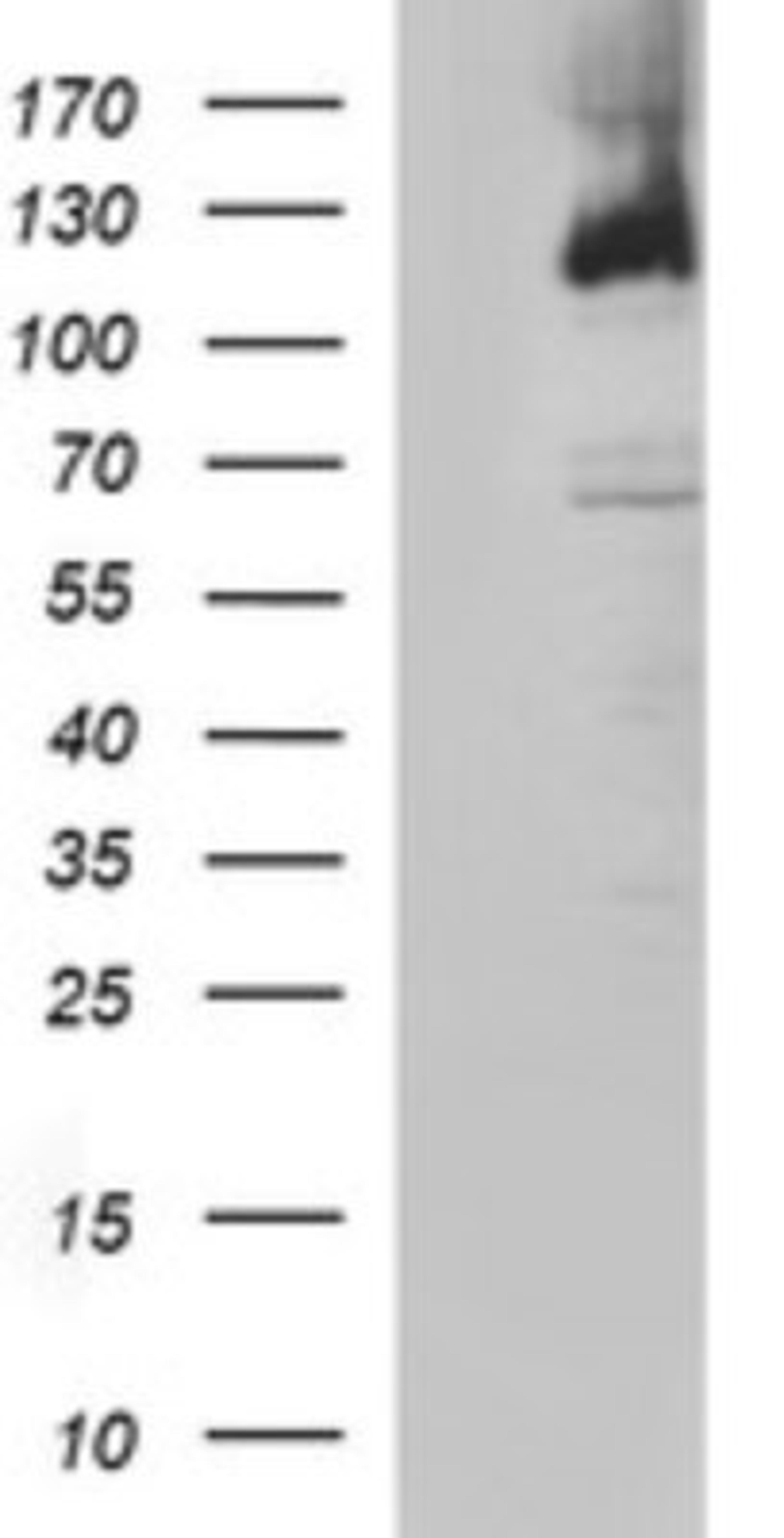 Western Blot: PMS2 Antibody (2G5) [NBP2-46459] - Analysis of HEK293T cells were transfected with the pCMV6-ENTRY control (Left lane) or pCMV6-ENTRY PMS2.