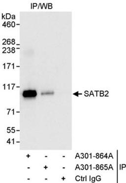 Detection of human SATB2 by western blot of immunoprecipitates.