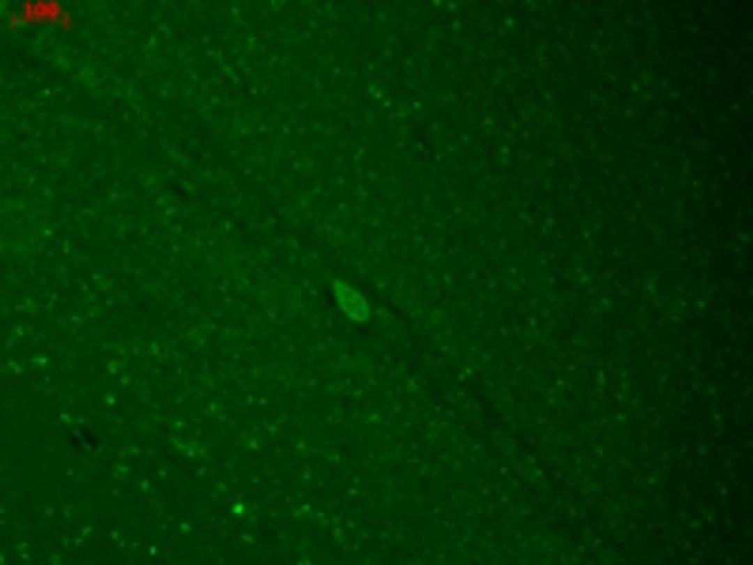 Immunocytochemistry/Immunofluorescence: KIR2.3 Antibody (S25-35) [NBP2-12902] - human hippocampal sections using this antibody.