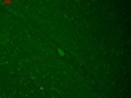 Immunocytochemistry/Immunofluorescence: KIR2.3 Antibody (S25-35) [NBP2-12902] - human hippocampal sections using this antibody.