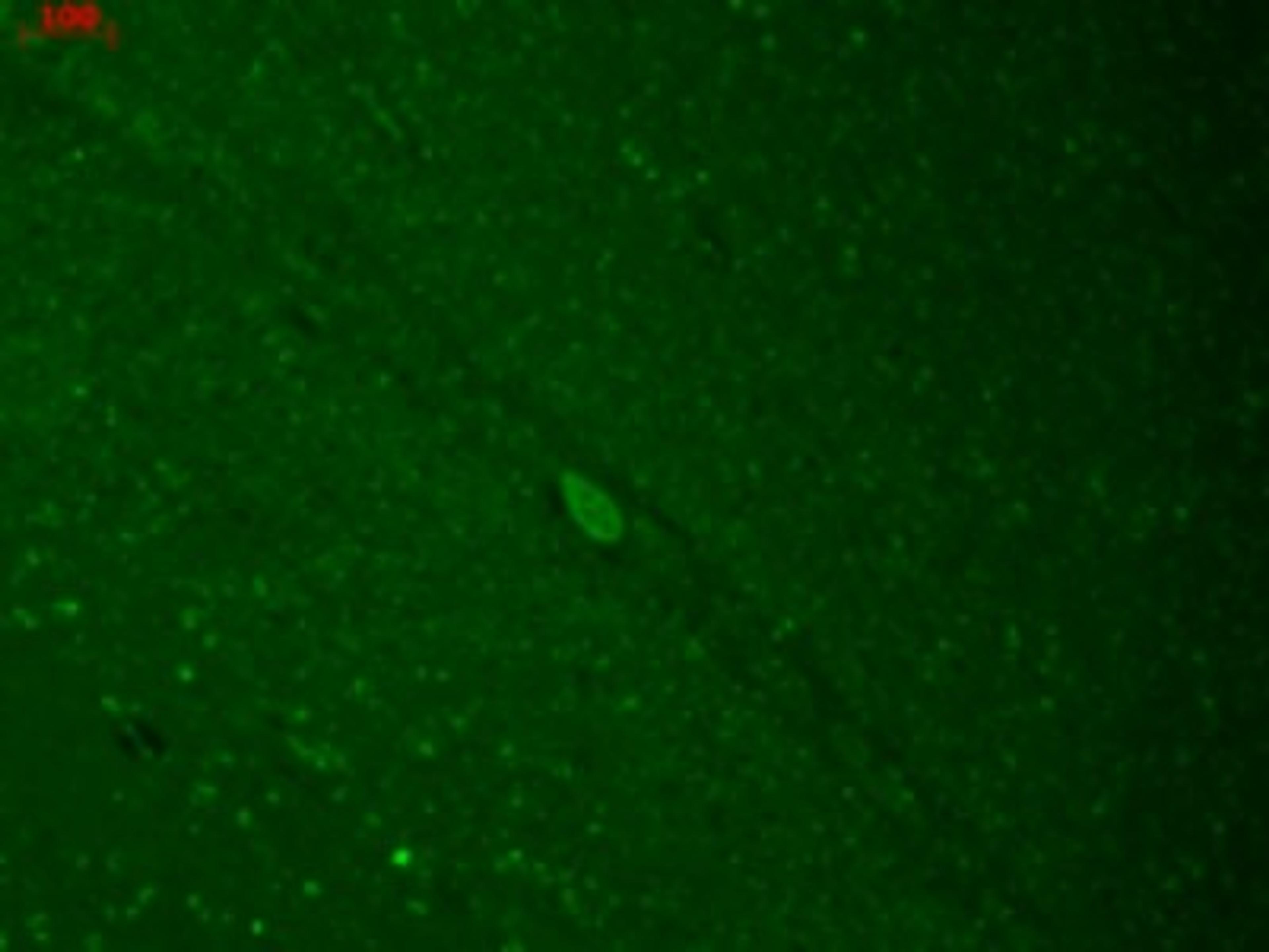 Immunocytochemistry/Immunofluorescence: KIR2.3 Antibody (S25-35) [NBP2-12902] - human hippocampal sections using this antibody.