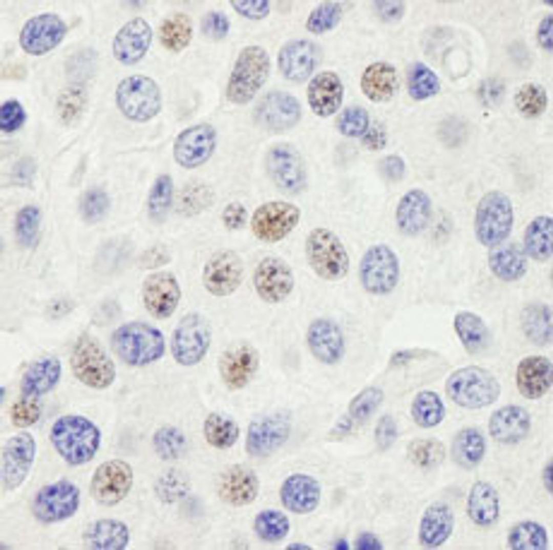 Detection of human PHF6 by immunohistochemistry.