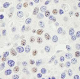 Detection of human PHF6 by immunohistochemistry.