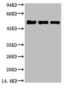 Western blot analysis of 1) Hela, 2) Mouse Brain Tissue, 3) Rat Brain Tissue, diluted at 1:5000.