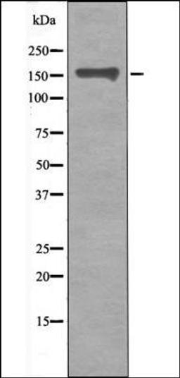 Western blot analysis of nocodazole treated HeLa whole cell lysates using CD130/gp130 -Phospho-Ser782- antibody