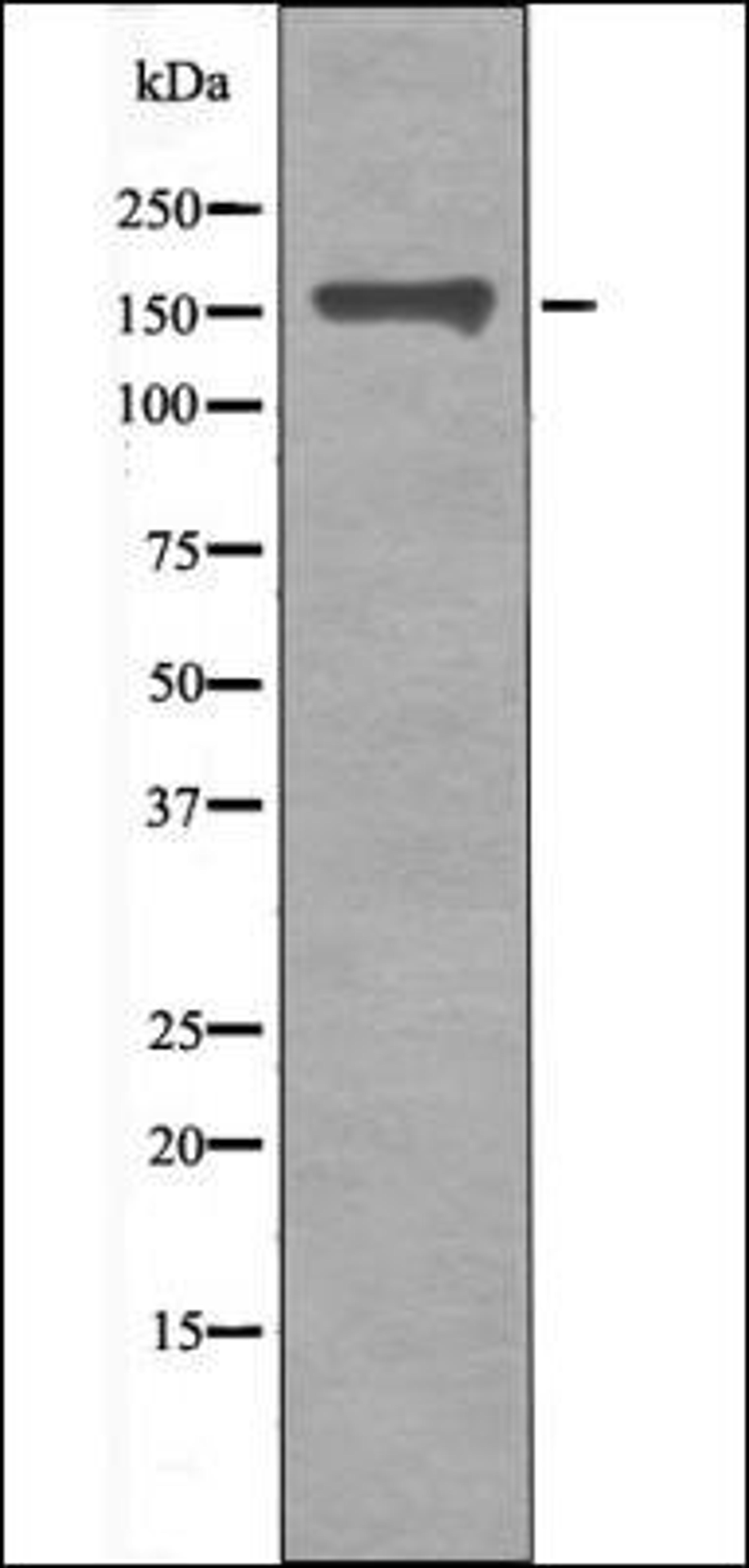 Western blot analysis of nocodazole treated HeLa whole cell lysates using CD130/gp130 -Phospho-Ser782- antibody