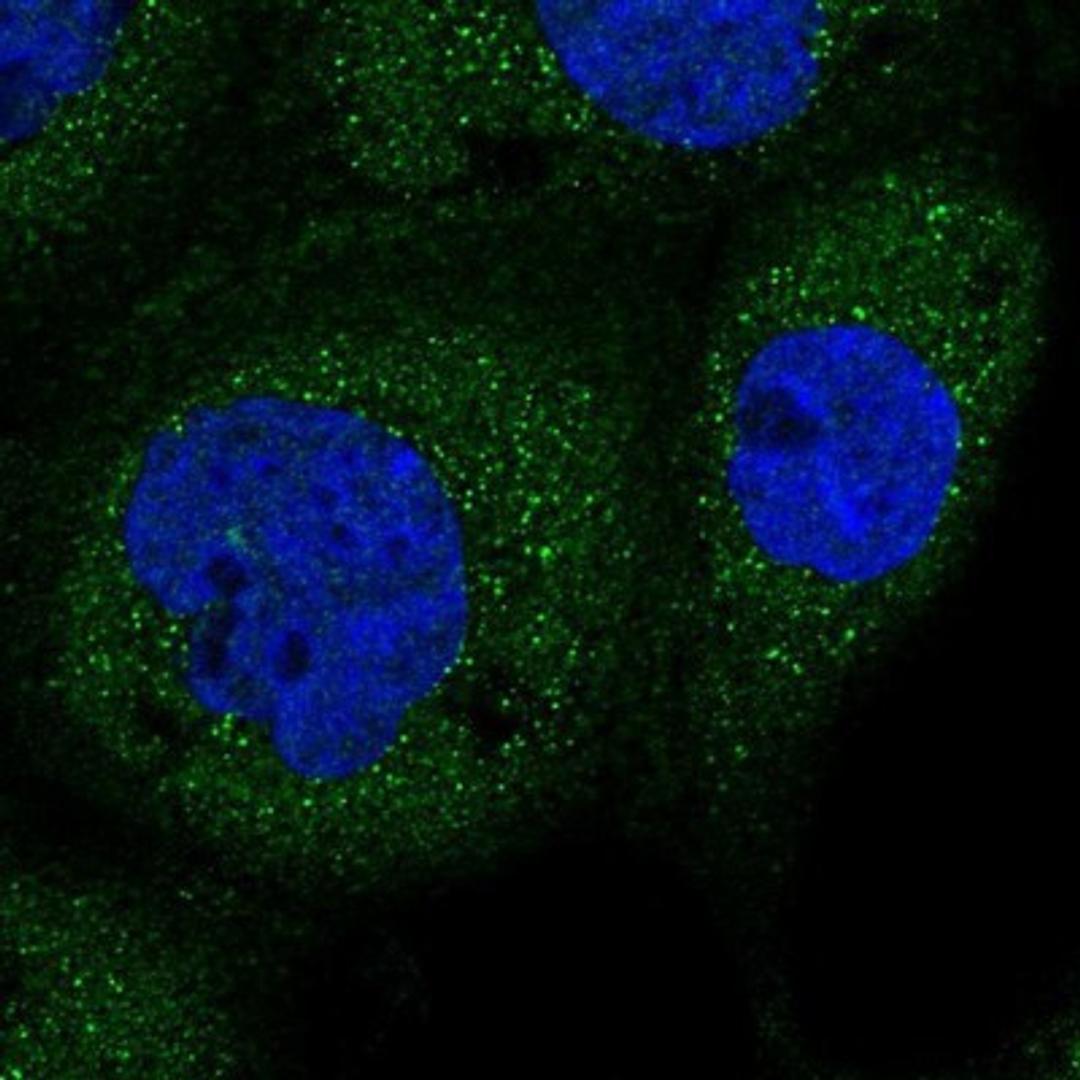 Immunocytochemistry/Immunofluorescence: TRAPPC2L Antibody [NBP1-83172] - Staining of human cell line A-431 shows positivity in cytoplasm.