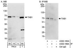 Detection of human TAB1 by western blot and immunoprecipitation.