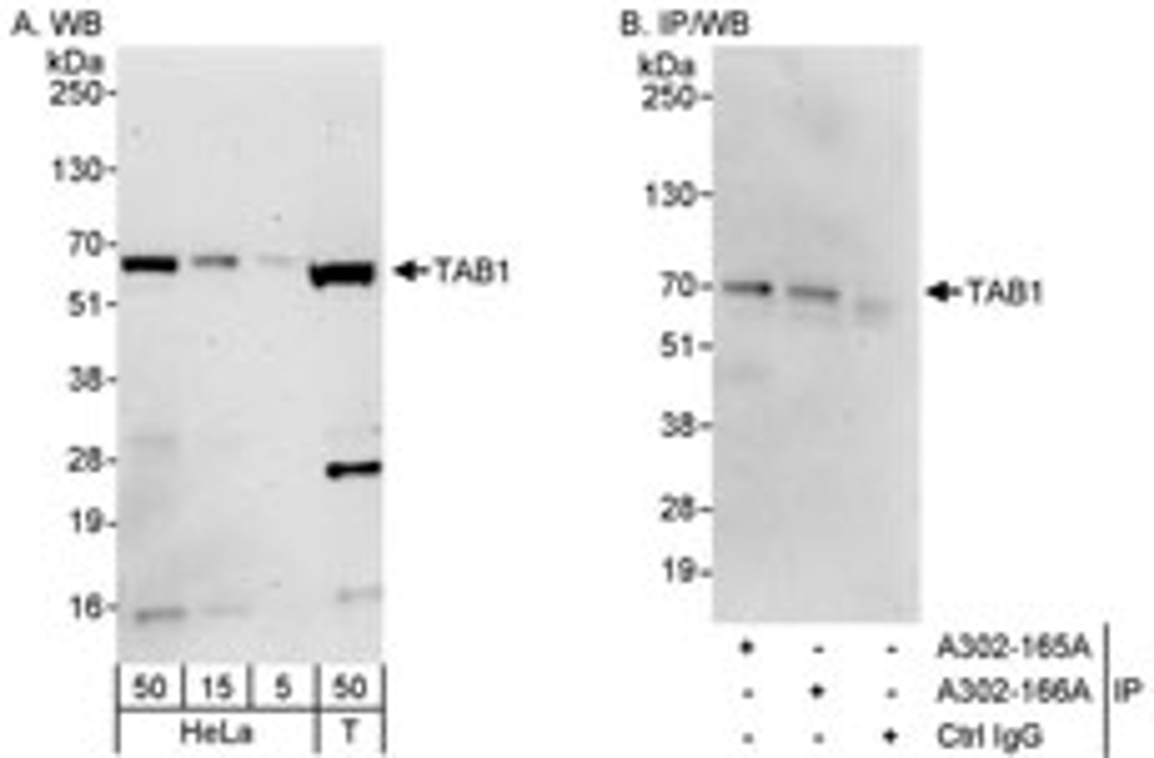 Detection of human TAB1 by western blot and immunoprecipitation.